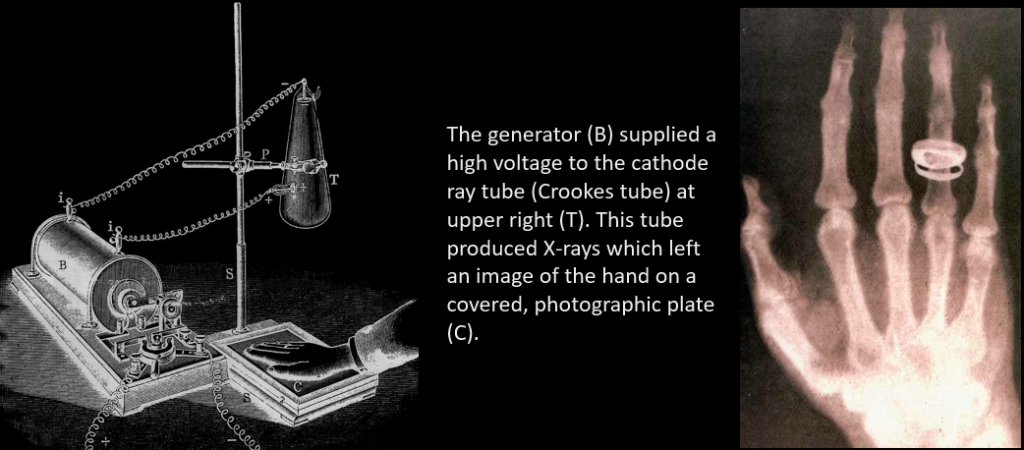 roentgen1